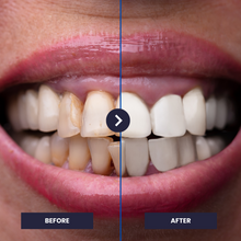 Załaduj obraz do przeglądarki galerii, OrthoVivid 2.0