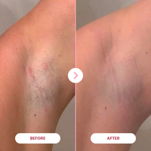 Załaduj obraz do przeglądarki galerii, 1x EpiLuxe
